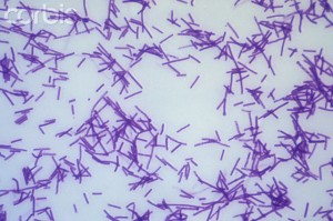 Clostridium tetani Bacteria